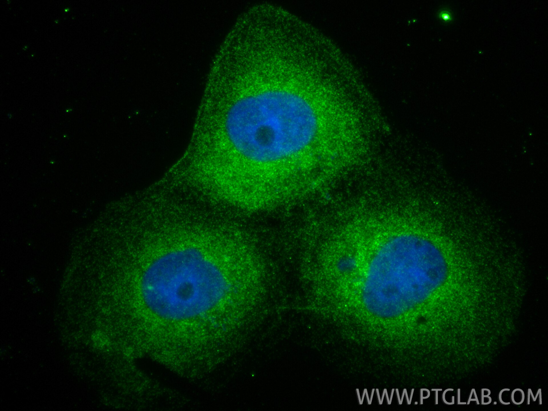Immunofluorescence (IF) / fluorescent staining of A431 cells using MAP3K4 Polyclonal antibody (21610-1-AP)