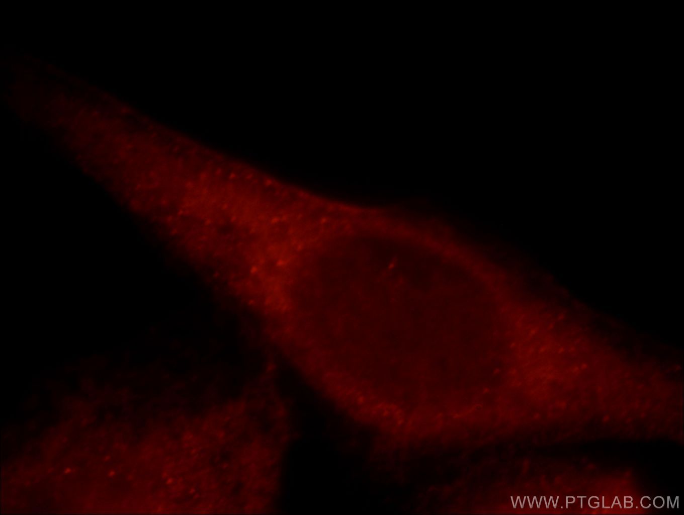 Immunofluorescence (IF) / fluorescent staining of HeLa cells using MAP3K4 Polyclonal antibody (21610-1-AP)