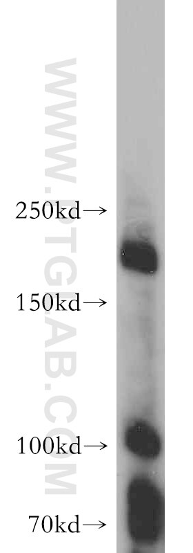 Western Blot (WB) analysis of K-562 cells using MAP3K4 Polyclonal antibody (21610-1-AP)