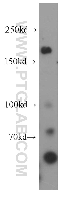 Western Blot (WB) analysis of K-562 cells using MAP3K4 Polyclonal antibody (21610-1-AP)