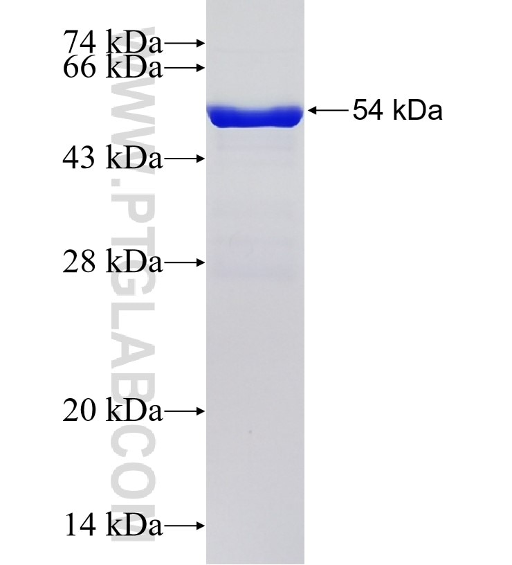 ASK1 fusion protein Ag5818 SDS-PAGE