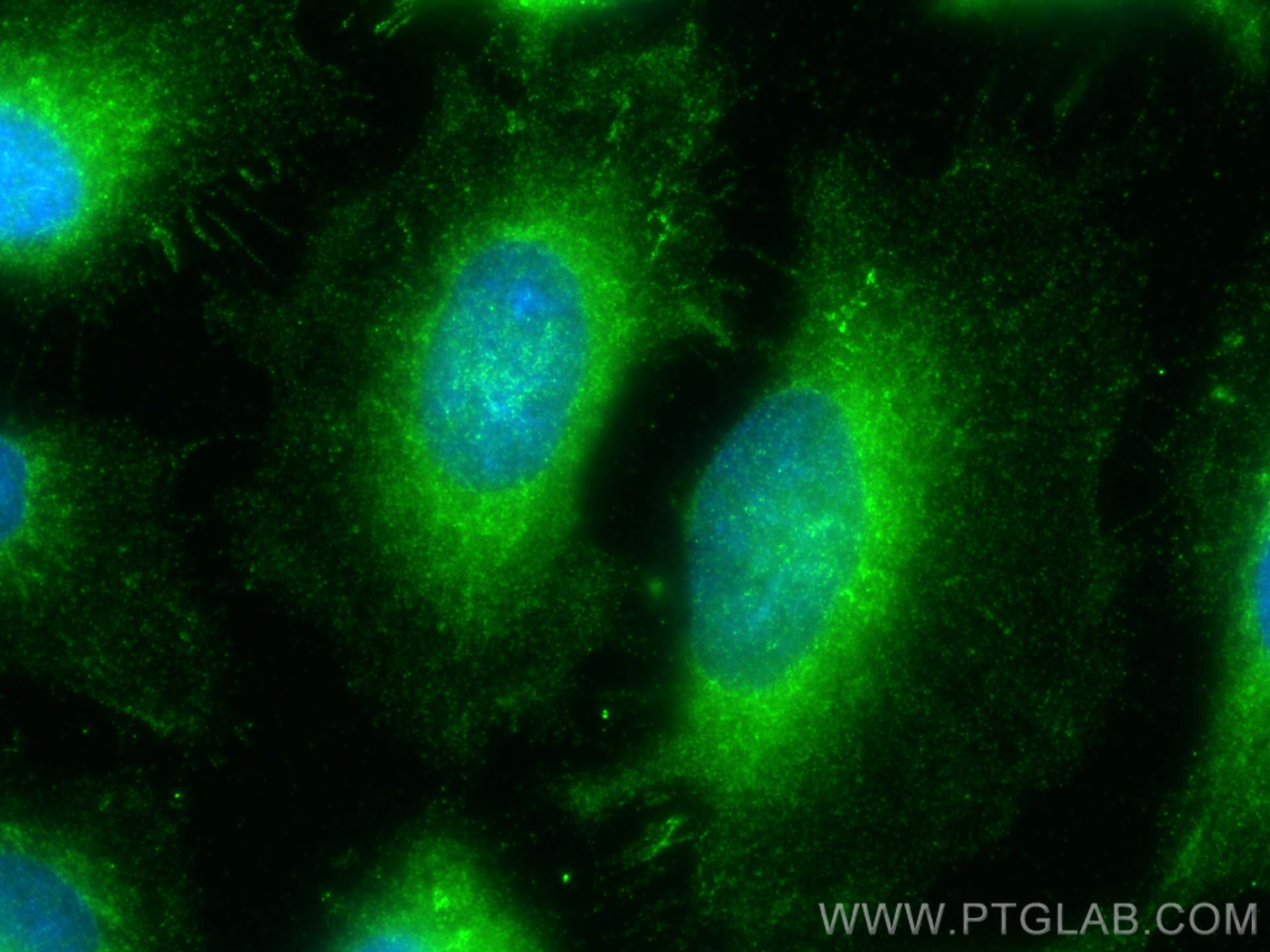 Immunofluorescence (IF) / fluorescent staining of HeLa cells using MAP3K6 Polyclonal antibody (16212-1-AP)