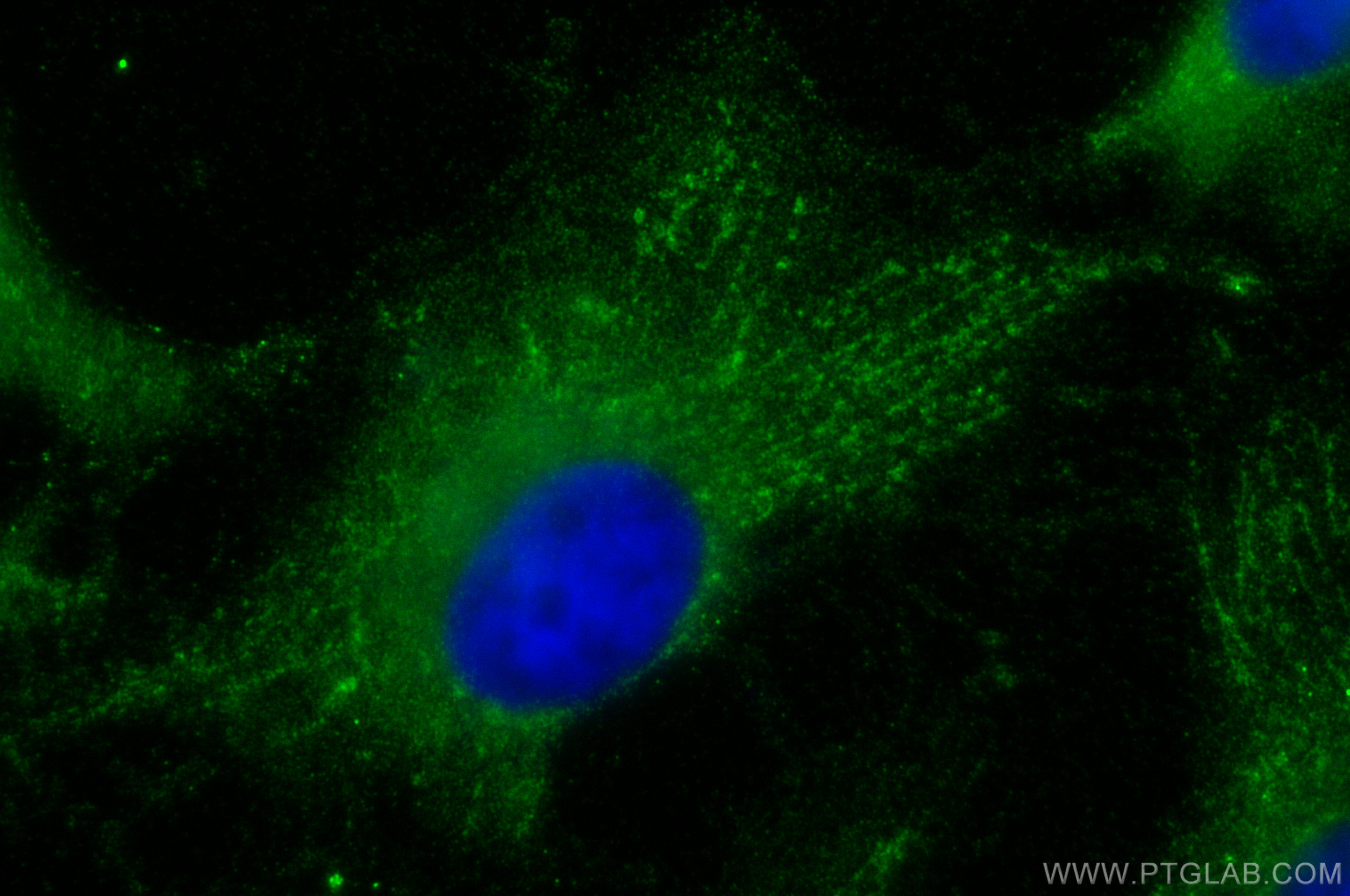 Immunofluorescence (IF) / fluorescent staining of HeLa cells using MAP3K6 Polyclonal antibody (16212-1-AP)