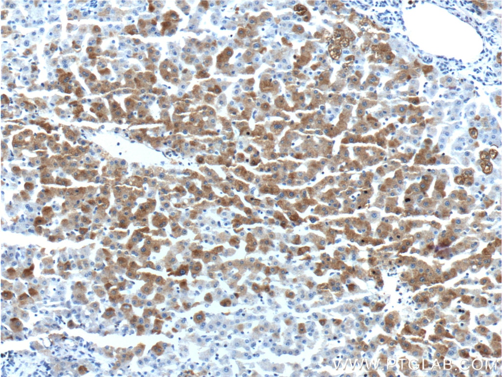 Immunohistochemistry (IHC) staining of human liver tissue using MAP3K6 Polyclonal antibody (16212-1-AP)