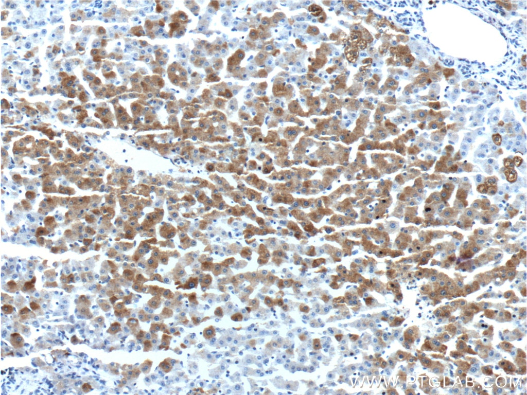 IHC staining of human liver using 16212-1-AP