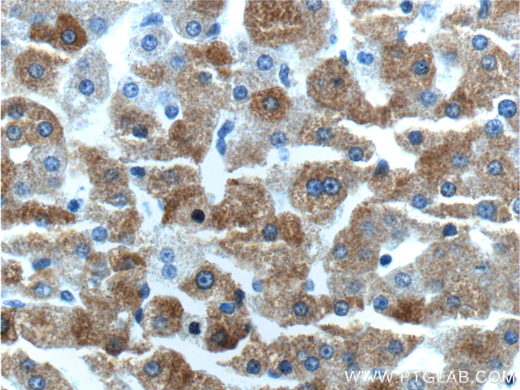 Immunohistochemistry (IHC) staining of human liver tissue using MAP3K6 Polyclonal antibody (16212-1-AP)