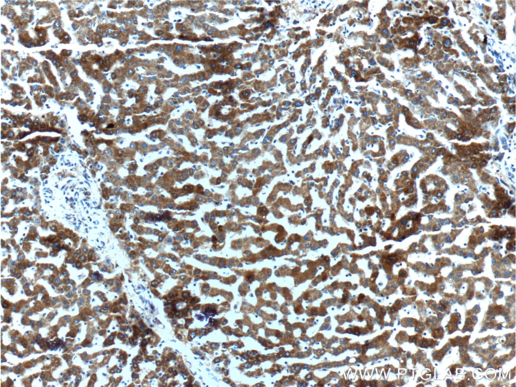 Immunohistochemistry (IHC) staining of human liver tissue using MAP3K6 Polyclonal antibody (16212-1-AP)