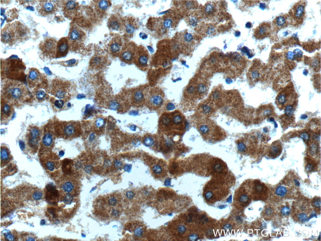 Immunohistochemistry (IHC) staining of human liver tissue using MAP3K6 Polyclonal antibody (16212-1-AP)