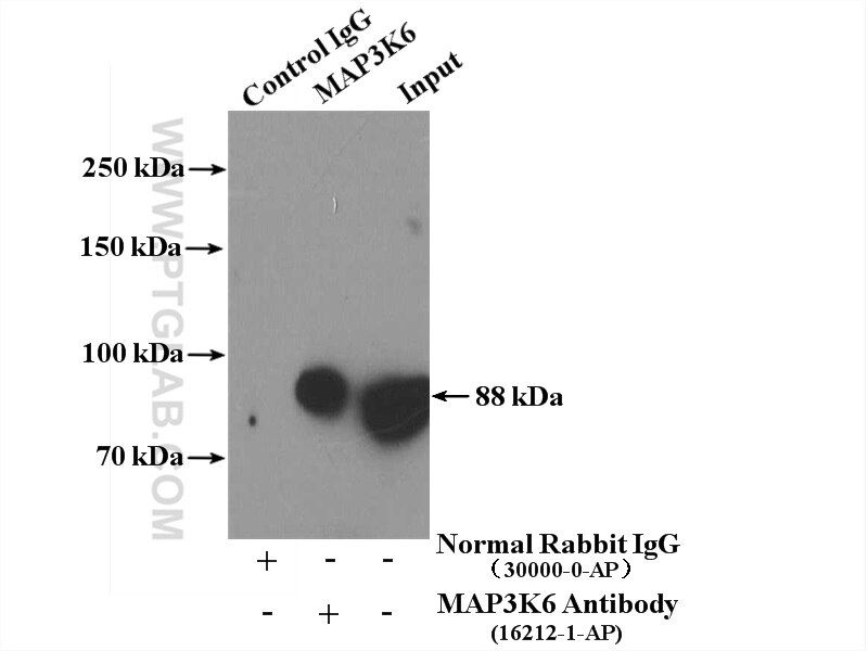 IP experiment of mouse liver using 16212-1-AP