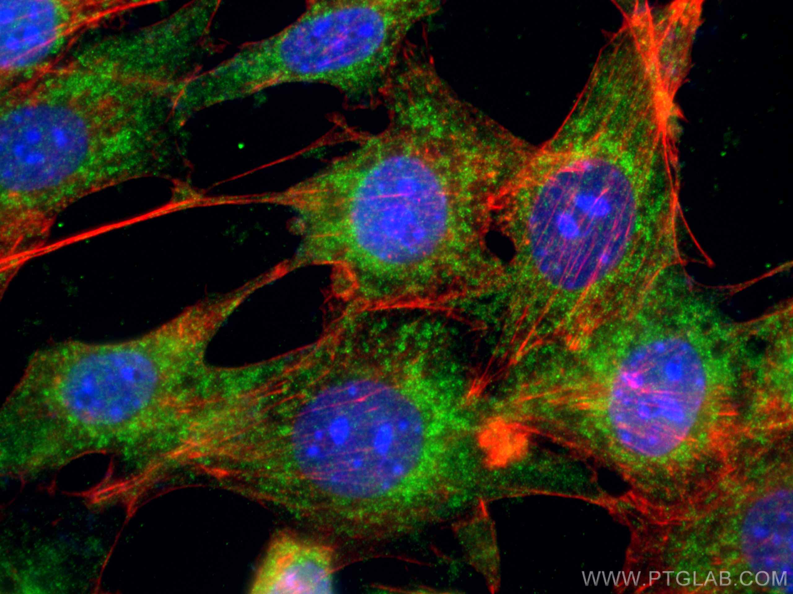 Immunofluorescence (IF) / fluorescent staining of NIH/3T3 cells using TAK1 Polyclonal antibody (12330-2-AP)