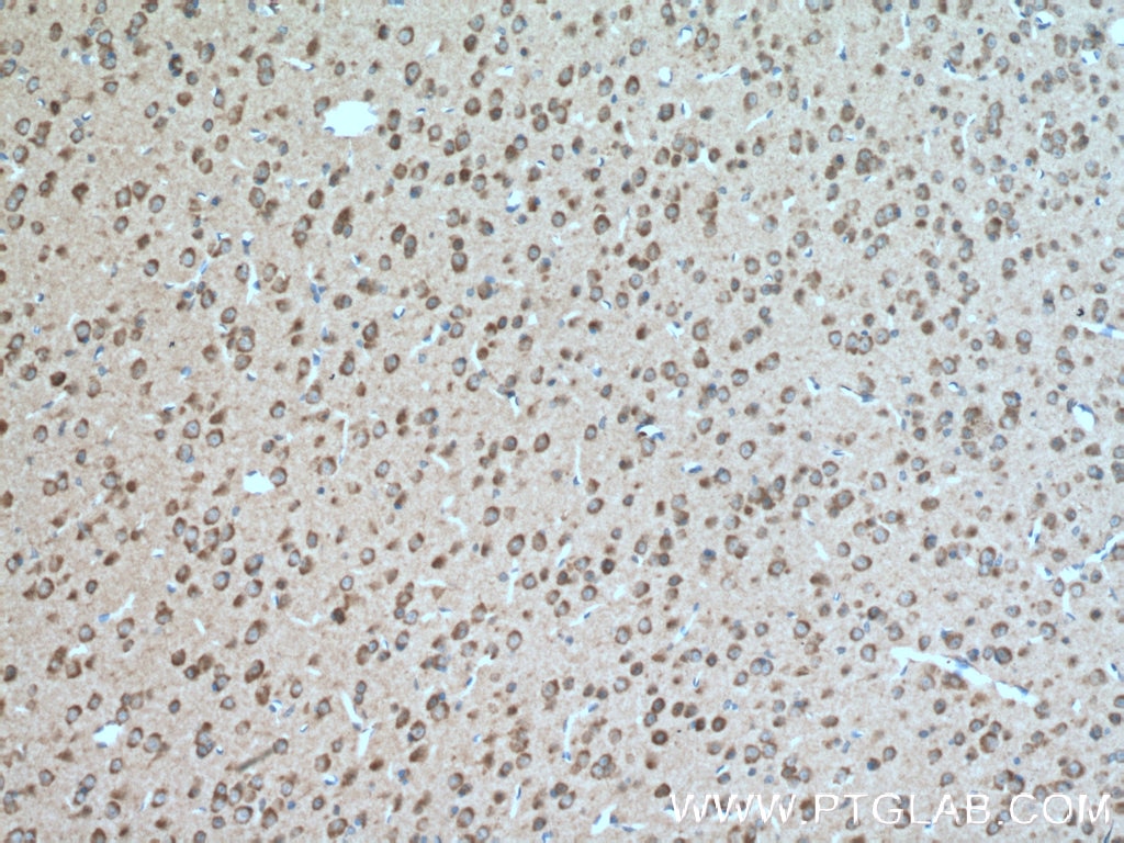 Immunohistochemistry (IHC) staining of mouse brain tissue using TAK1 Polyclonal antibody (12330-2-AP)