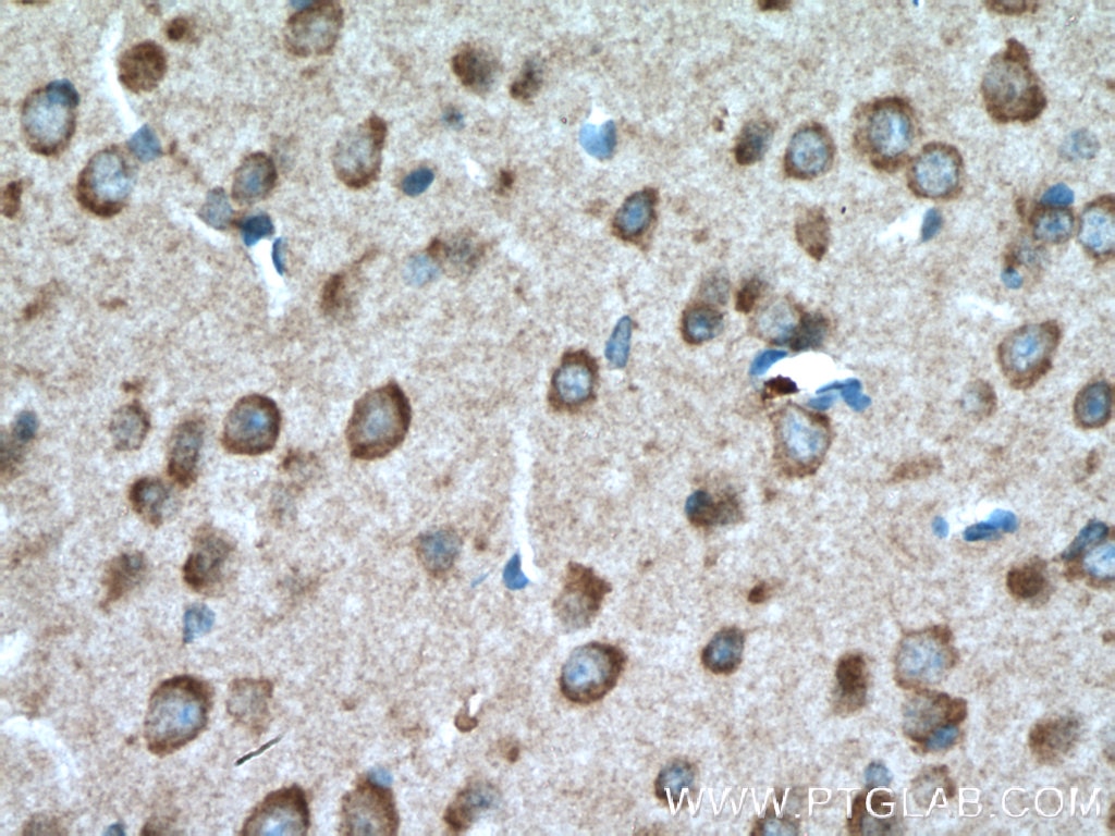 IHC staining of mouse brain using 12330-2-AP