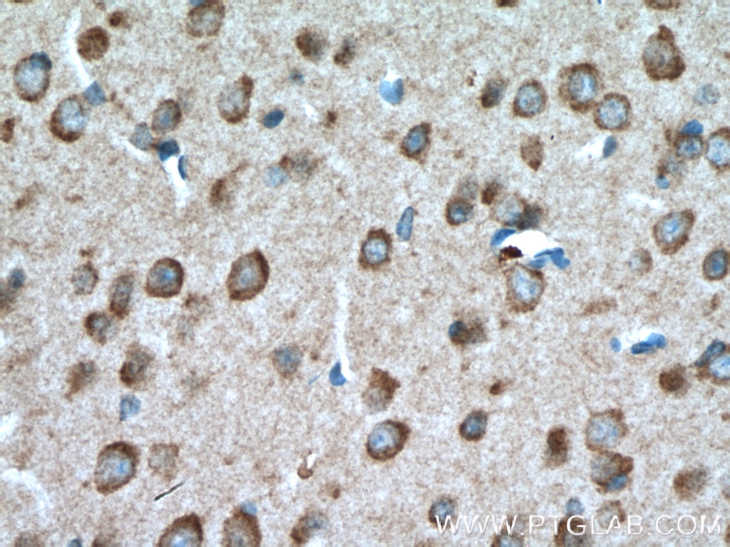 Immunohistochemistry (IHC) staining of mouse brain tissue using TAK1 Polyclonal antibody (12330-2-AP)