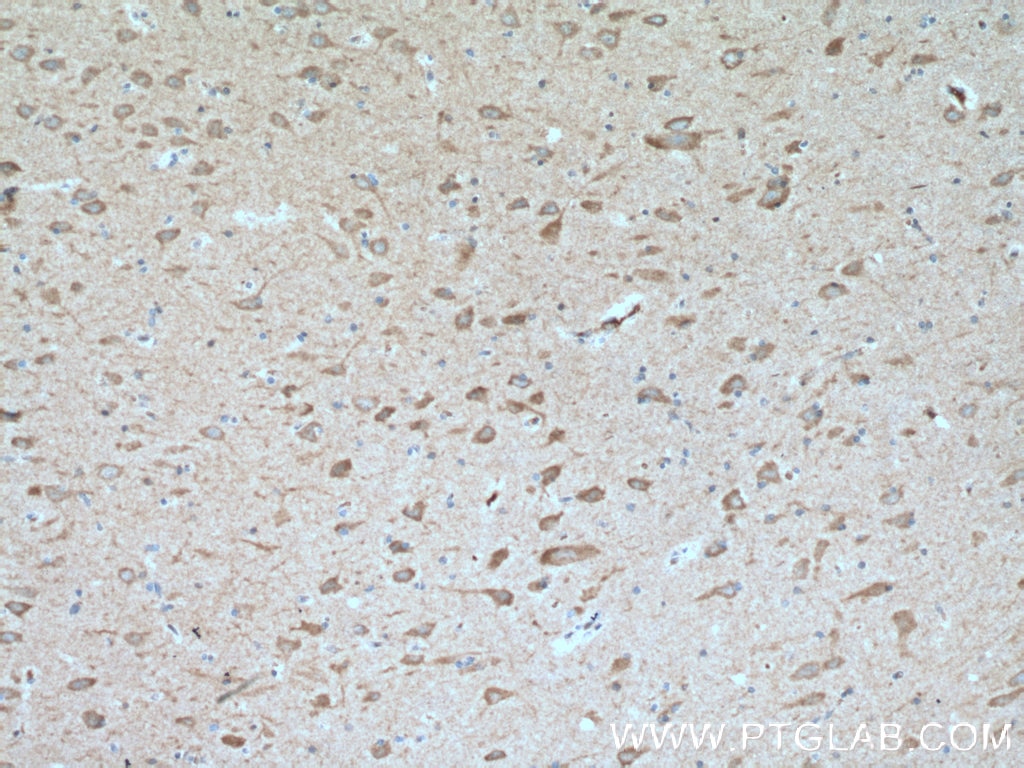 Immunohistochemistry (IHC) staining of human brain tissue using TAK1 Polyclonal antibody (12330-2-AP)