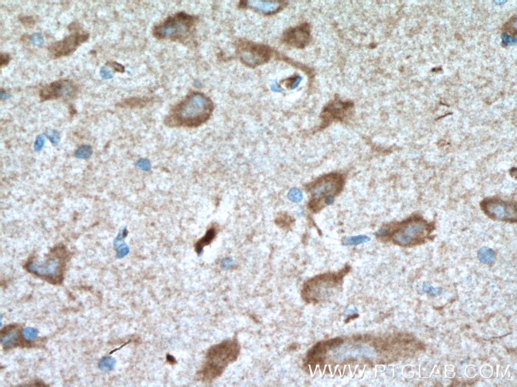 Immunohistochemistry (IHC) staining of human brain tissue using TAK1 Polyclonal antibody (12330-2-AP)