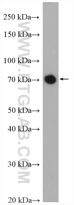 Western Blot (WB) analysis of SKOV-3 cells using TAK1 Polyclonal antibody (12330-2-AP)