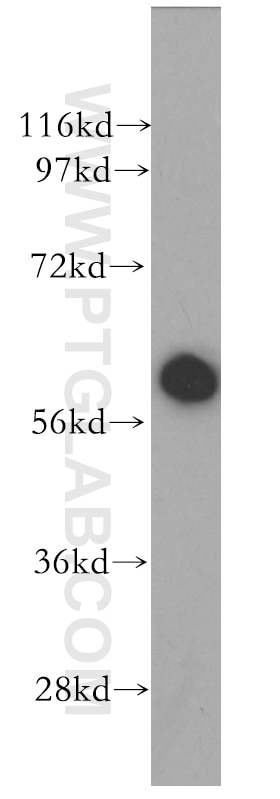 Western Blot (WB) analysis of COLO 320 cells using TAK1 Polyclonal antibody (12330-2-AP)