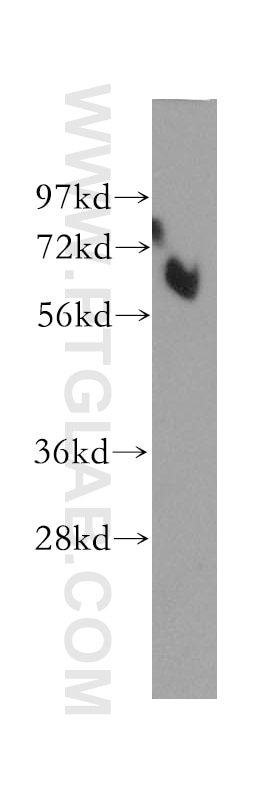 Western Blot (WB) analysis of A375 cells using TAK1 Polyclonal antibody (12330-2-AP)