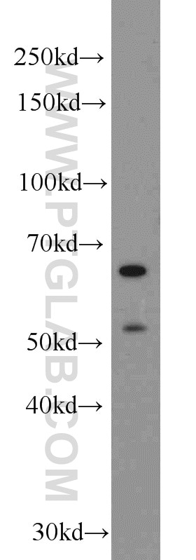 Western Blot (WB) analysis of A431 cells using TAK1 Polyclonal antibody (12330-2-AP)