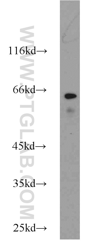 Western Blot (WB) analysis of CHO cells using TAK1 Polyclonal antibody (12330-2-AP)