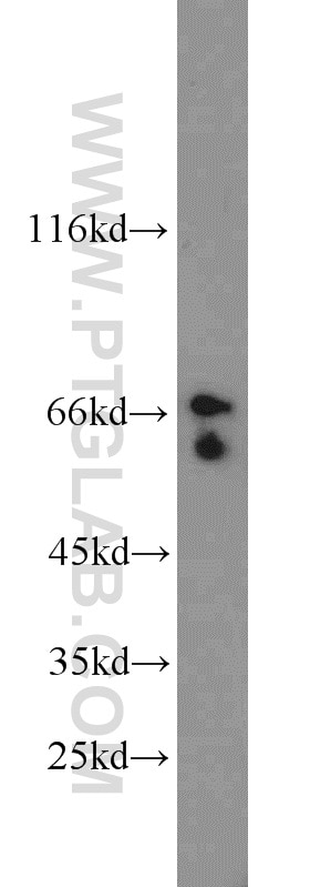 Western Blot (WB) analysis of MCF-7 cells using TAK1 Polyclonal antibody (12330-2-AP)