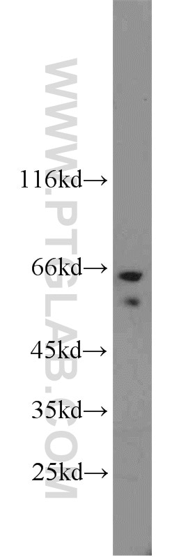 Western Blot (WB) analysis of HeLa cells using TAK1 Polyclonal antibody (12330-2-AP)