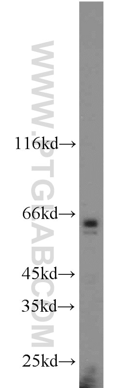 Western Blot (WB) analysis of mouse heart tissue using TAK1 Polyclonal antibody (12330-2-AP)