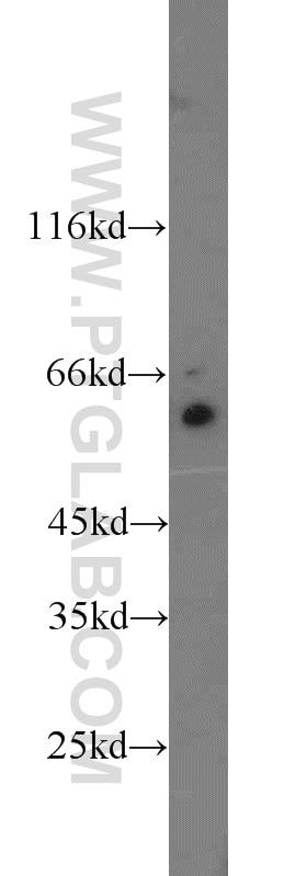 Western Blot (WB) analysis of A2780 cells using TAK1 Polyclonal antibody (12330-2-AP)