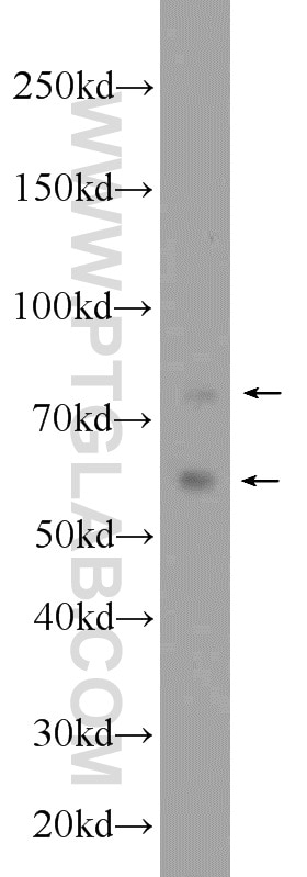 Western Blot (WB) analysis of K-562 cells using TAK1 Polyclonal antibody (12330-2-AP)