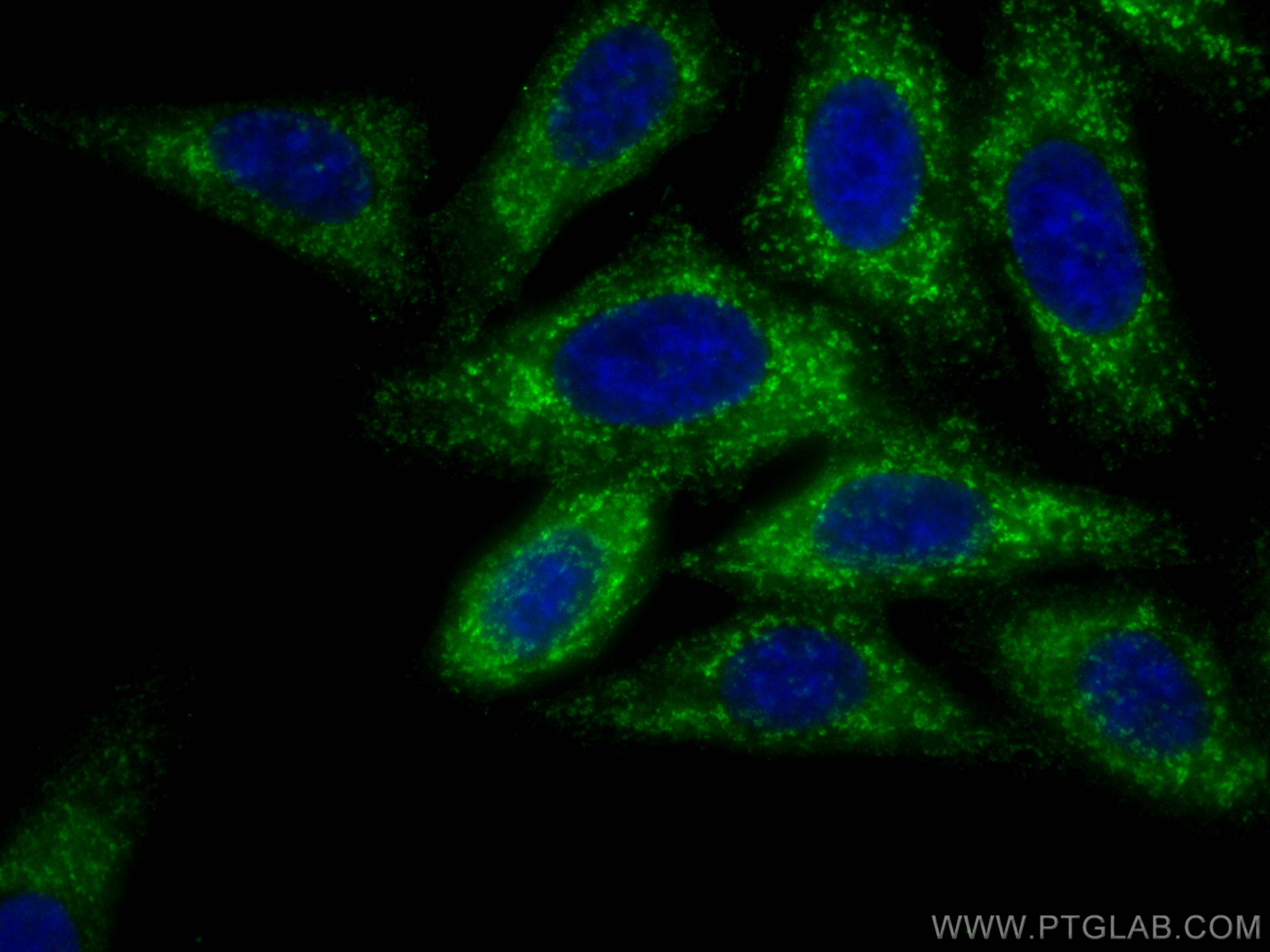 Immunofluorescence (IF) / fluorescent staining of HepG2 cells using TAK1 Monoclonal antibody (67707-1-Ig)