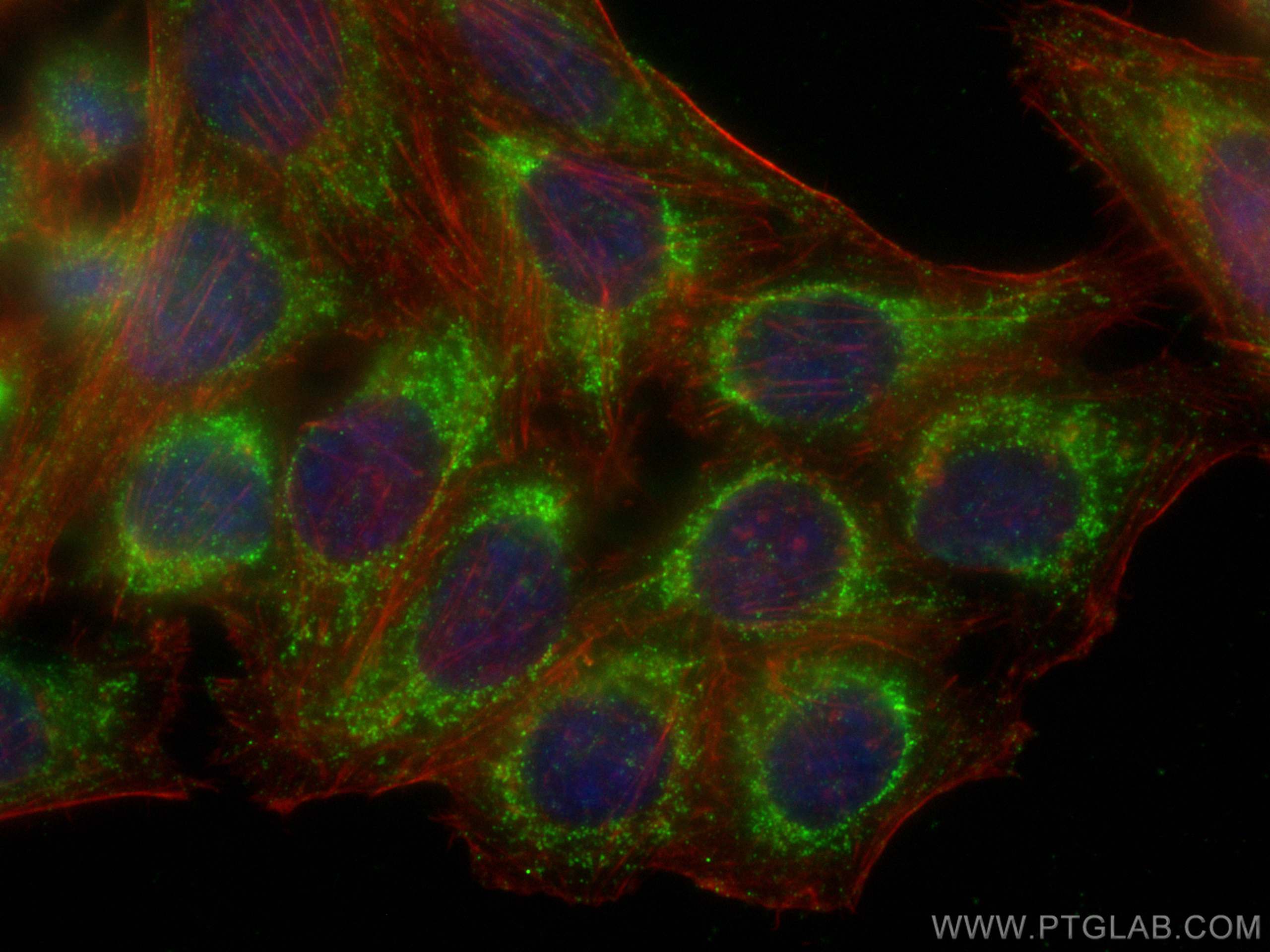 Immunofluorescence (IF) / fluorescent staining of HepG2 cells using TAK1 Monoclonal antibody (67707-1-Ig)