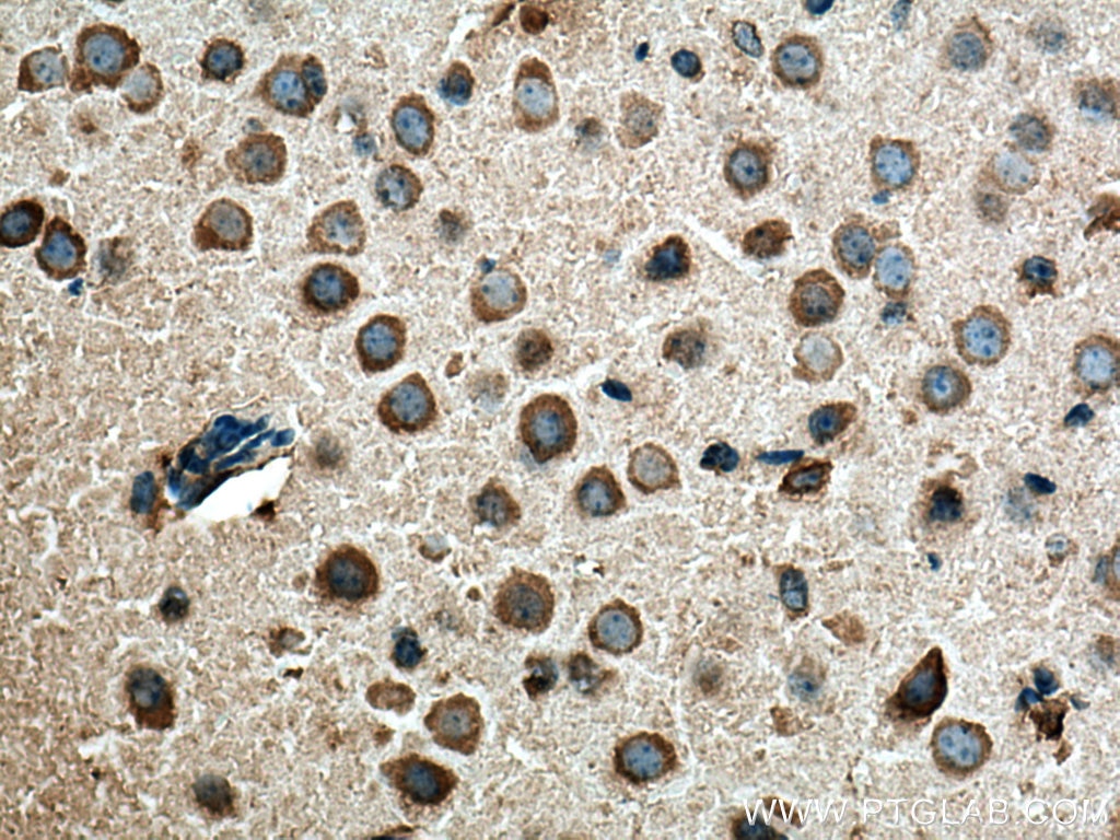 Immunohistochemistry (IHC) staining of mouse brain tissue using TAK1 Monoclonal antibody (67707-1-Ig)