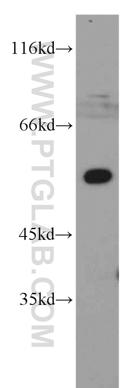 TAB1 Polyclonal antibody