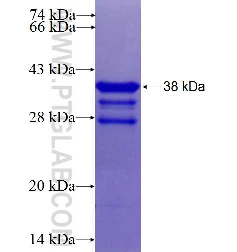 MAP3K7IP1 fusion protein Ag25576 SDS-PAGE