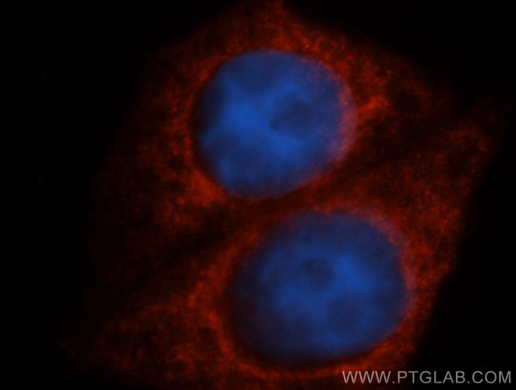 Immunofluorescence (IF) / fluorescent staining of HepG2 cells using TAB2 Polyclonal antibody (14410-1-AP)