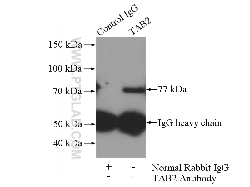 Immunoprecipitation (IP) experiment of HepG2 cells using TAB2 Polyclonal antibody (14410-1-AP)