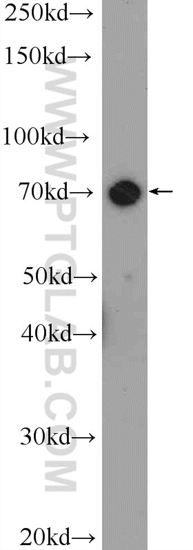 Western Blot (WB) analysis of L02 cells using TAB2 Polyclonal antibody (14410-1-AP)