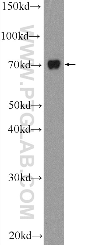 WB analysis of HepG2 using 14410-1-AP