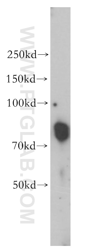 Western Blot (WB) analysis of human liver tissue using TAB2 Polyclonal antibody (14410-1-AP)