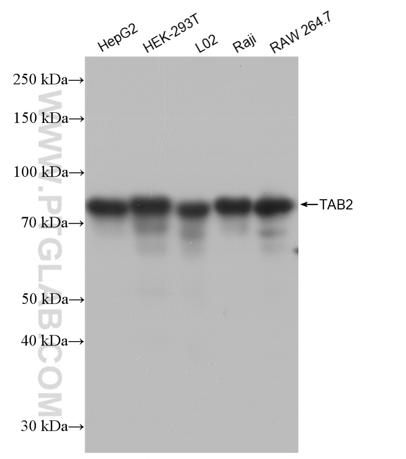 Western Blot (WB) analysis of various lysates using MAP3K7IP2 Recombinant antibody (82948-1-RR)