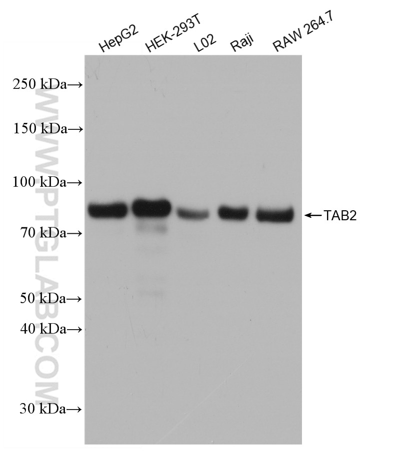Western Blot (WB) analysis of various lysates using human MAP3K7IP2 Recombinant antibody (82948-5-RR)