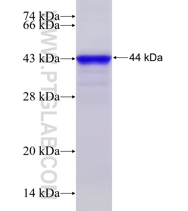 MAP3K7IP2 fusion protein Ag5917 SDS-PAGE