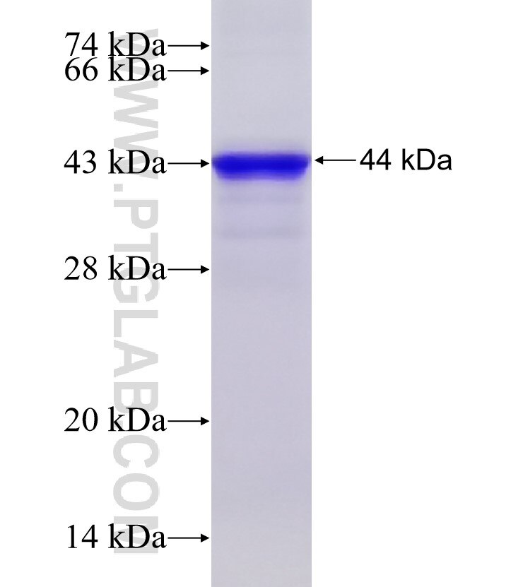 MAP3K7IP2 fusion protein Ag5917 SDS-PAGE