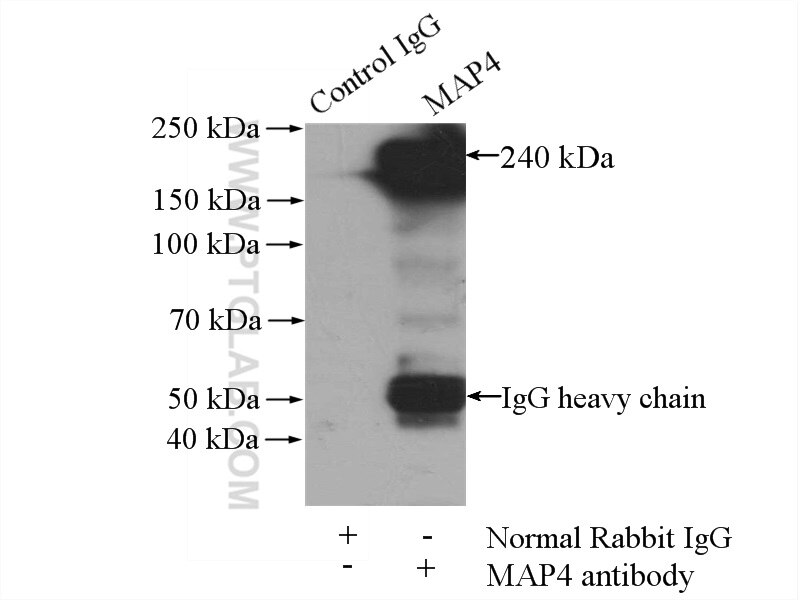Immunoprecipitation (IP) experiment of HEK-293 cells using MAP4 Polyclonal antibody (11229-1-AP)