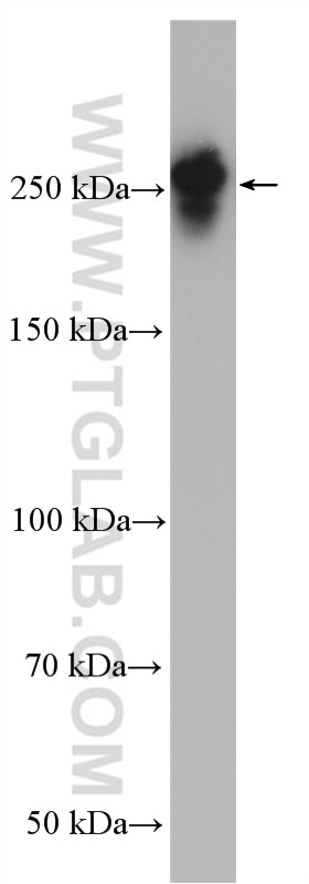 Western Blot (WB) analysis of C6 cells using MAP4 Polyclonal antibody (11229-1-AP)