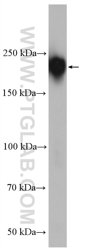 WB analysis of HEK-293 using 11229-1-AP