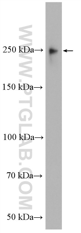 Western Blot (WB) analysis of C2C12 cells using MAP4 Polyclonal antibody (11229-1-AP)