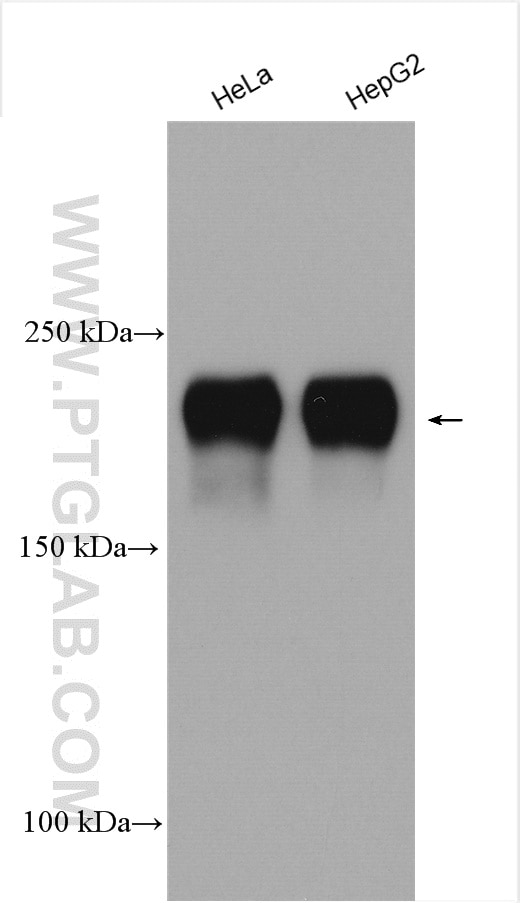 Western Blot (WB) analysis of various lysates using MAP4 Polyclonal antibody (11229-1-AP)