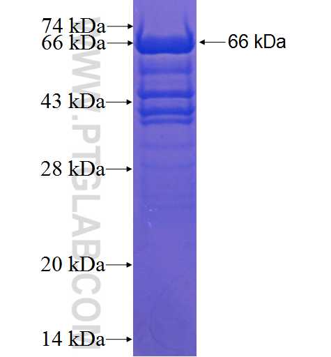MAP4 fusion protein Ag1741 SDS-PAGE