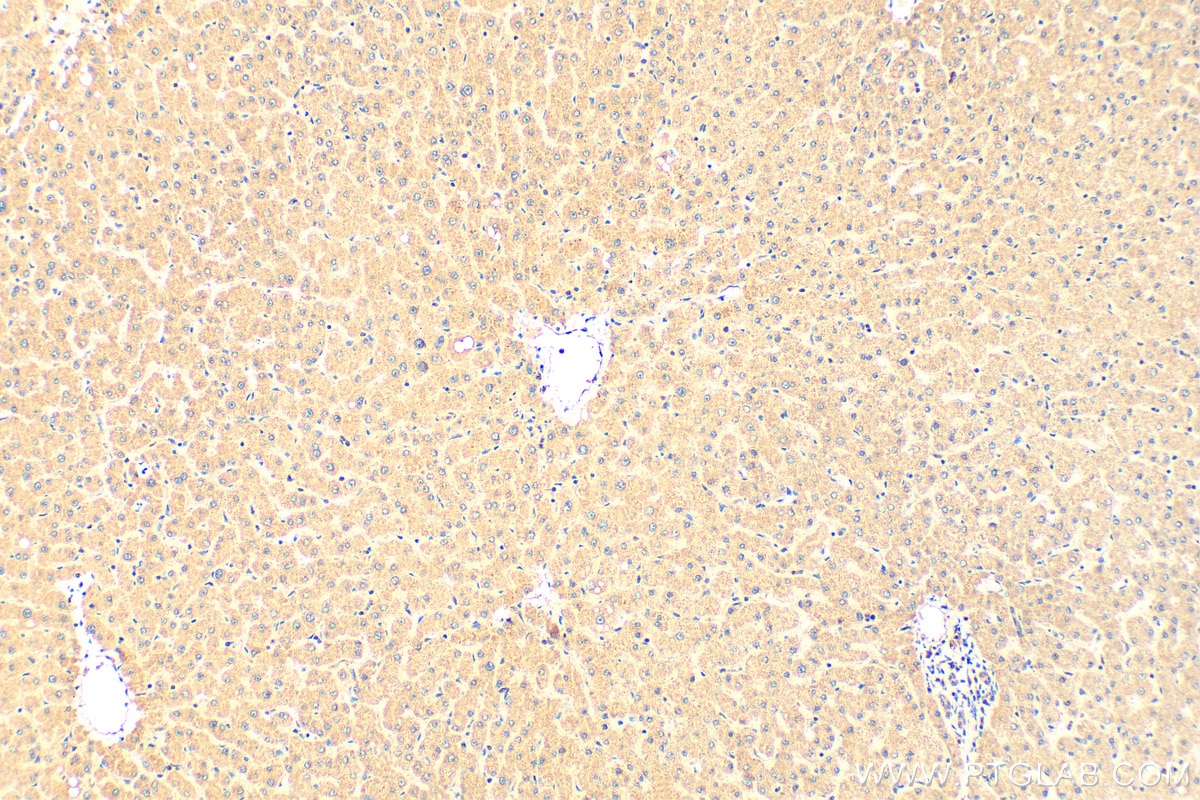 Immunohistochemistry (IHC) staining of human liver tissue using MAP4K1 Polyclonal antibody (23950-1-AP)